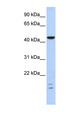 BTBD6 Antibody - BTBD6 antibody Western blot of Fetal Brain lysate. This image was taken for the unconjugated form of this product. Other forms have not been tested.