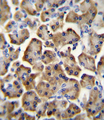 BTC / Betacellulin Antibody - BTC Antibody immunohistochemistry of formalin-fixed and paraffin-embedded human pancreas tissue followed by peroxidase-conjugated secondary antibody and DAB staining.