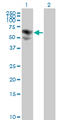 BTD / Biotinidase Antibody - Western Blot analysis of BTD expression in transfected 293T cell line by BTD monoclonal antibody (M01), clone 3B10-2B3.Lane 1: BTD transfected lysate(61.1 KDa).Lane 2: Non-transfected lysate.