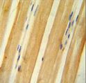BTF / BCLAF1 Antibody - BCLAF1 antibody immunohistochemistry of formalin-fixed and paraffin-embedded human skeletal muscle followed by peroxidase-conjugated secondary antibody and DAB staining.