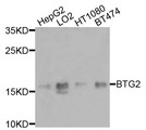 BTG2 Antibody - Western blot analysis of extracts of various cells.