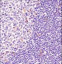 BTK Antibody - BTK Antibody immunohistochemistry of formalin-fixed and paraffin-embedded human tonsil tissue followed by peroxidase-conjugated secondary antibody and DAB staining.