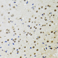 BTK Antibody - Immunohistochemistry of paraffin-embedded mouse brain using BTK antibodyat dilution of 1:100 (40x lens).
