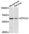 BTN1A1 Antibody - Western blot analysis of extracts of various cell lines, using BTN1A1 antibody at 1:1000 dilution. The secondary antibody used was an HRP Goat Anti-Rabbit IgG (H+L) at 1:10000 dilution. Lysates were loaded 25ug per lane and 3% nonfat dry milk in TBST was used for blocking. An ECL Kit was used for detection and the exposure time was 10s.