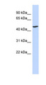 BTNL3 Antibody - BTNL3 antibody Western blot of Fetal Lung lysate. This image was taken for the unconjugated form of this product. Other forms have not been tested.