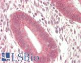 BTRCP / BETA-TRCP Antibody - Human Uterus: Formalin-Fixed, Paraffin-Embedded (FFPE)
