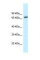 BTRCP / BETA-TRCP Antibody - BTRC / bTrCP antibody Western blot of Mouse Pancreas lysate. Antibody concentration 1 ug/ml.  This image was taken for the unconjugated form of this product. Other forms have not been tested.