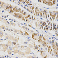 BTRCP / BETA-TRCP Antibody - Immunohistochemistry of paraffin-embedded human stomach using BTRC antibody at dilution of 1:200 (x400 lens)