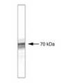 BTRCP / BETA-TRCP Antibody - Western blot of HEK 293 cells transfected with b-TrCP