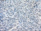 BUB1B / BubR1 Antibody - IHC of paraffin-embedded endometrium tissue using anti-BUB1B mouse monoclonal antibody. (Dilution 1:50).