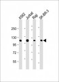 c-CBL Antibody - All lanes: Anti-CBL Antibody at 1:2000 dilution Lane 1: K562 whole cell lysate Lane 2: Jurkat whole cell lysate Lane 3: Raji whole cell lysate Lane 4: SK-BR-3 whole cell lysate Lysates/proteins at 20 µg per lane. Secondary Goat Anti-mouse IgG, (H+L), Peroxidase conjugated at 1/10000 dilution. Predicted band size: 100 kDa Blocking/Dilution buffer: 5% NFDM/TBST.