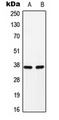 C/EBP Alpha / CEBPA Antibody - Western blot analysis of C/EBP alpha (pS193) expression in H9C2 (A); Raw264.7 (B) whole cell lysates.