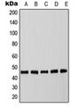 C/EBP Alpha / CEBPA Antibody - Western blot analysis of C/EBP alpha (pT226) expression in MCF7 EGF-treated (A); mouse spleen (B); mouse liver (C); rat spleen (D); rat liver (E) whole cell lysates.