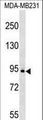 c-Kit / CD117 Antibody - KIT Antibody (C-term S821/Y823) western blot of MDA-MB231 cell line lysates (35 ug/lane). The KIT antibody detected the KIT protein (arrow).