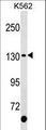 c-Kit / CD117 Antibody - KIT Antibody (C-term Y900)western blot of K562 cell line lysates (35 ug/lane). The KIT antibody detected the KIT protein (arrow).