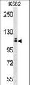 c-Kit / CD117 Antibody - KIT Antibody (Q927) western blot of K562 cell line lysates (35 ug/lane). The KIT antibody detected the KIT protein (arrow).