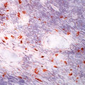 c-Kit / CD117 Antibody - Frozen human tonsil section stained UltraVision LP and AEC chromogen. Note staining of mast cells.  This image was taken for the unmodified form of this product. Other forms have not been tested.