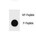 c-Kit / CD117 Antibody - Dot blot of Phospho-KIT-Y578 Antibody Phospho-specific antibody on nitrocellulose membrane. 50ng of Phospho-peptide or Non Phospho-peptide per dot were adsorbed. Antibody working concentrations are 0.6ug per ml.