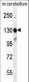 c-Kit / CD117 Antibody - Western blot of KIT Antibody (Y703) in mouse cerebellum tissue lysates (35 ug/lane). KIT (arrow) was detected using the purified antibody.