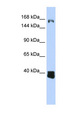 C10orf12 Antibody - C10orf12 antibody Western blot of Jurkat lysate. This image was taken for the unconjugated form of this product. Other forms have not been tested.