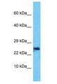 C10orf131 Antibody - C10orf131 antibody Western Blot of HepG2. Antibody dilution: 1 ug/ml.  This image was taken for the unconjugated form of this product. Other forms have not been tested.
