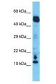 C10orf55 Antibody - C10orf55 antibody Western Blot of Esophagus Tumor. Antibody dilution: 1 ug/ml.  This image was taken for the unconjugated form of this product. Other forms have not been tested.