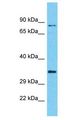 C10orf71 Antibody - C10orf71 antibody Western Blot of HCT15. Antibody dilution: 1 ug/ml.  This image was taken for the unconjugated form of this product. Other forms have not been tested.