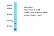 C10orf95 Antibody -  This image was taken for the unconjugated form of this product. Other forms have not been tested.
