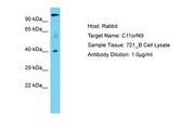 C11orf49 Antibody -  This image was taken for the unconjugated form of this product. Other forms have not been tested.