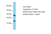 C11orf52 Antibody -  This image was taken for the unconjugated form of this product. Other forms have not been tested.