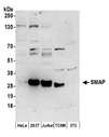 C11orf58 Antibody - Detection of human and mouse SMAP by western blot. Samples: Whole cell lysate (50 µg) from HeLa, HEK293T, Jurkat, mouse TCMK-1, and mouse NIH 3T3 cells prepared using NETN lysis buffer. Antibodies: Affinity purified rabbit anti-SMAP antibody used for WB at 0.1 µg/ml. Detection: Chemiluminescence with an exposure time of 3 minutes.