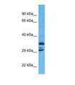 C11orf65 Antibody - Western blot of Human Stomach tumor. C11orf65 antibody dilution 1.0 ug/ml.  This image was taken for the unconjugated form of this product. Other forms have not been tested.