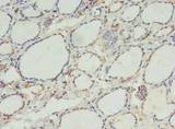 C11orf68 Antibody - Immunohistochemistry of paraffin-embedded human thyroid using antibody at dilution of 1:100.