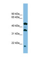 C11orf73 Antibody - C11orf73 antibody Western blot of ACHN lysate. This image was taken for the unconjugated form of this product. Other forms have not been tested.