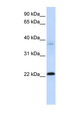 C11orf74 Antibody - C11orf74 antibody Western blot of Fetal Muscle lysate. This image was taken for the unconjugated form of this product. Other forms have not been tested.