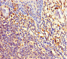 C11orf85 Antibody - Immunohistochemistry of paraffin-embedded human tonsil tissue using MAJIN Antibody at dilution of 1:100
