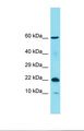 C11orf87 Antibody - Western blot of Human COLO205. C11orf87 antibody dilution 1.0 ug/ml.  This image was taken for the unconjugated form of this product. Other forms have not been tested.