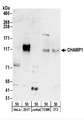 C13orf8 / ZNF828 Antibody - Detection of Human and Mouse CHAMP1 by Western Blot. Samples: Whole cell lysate (50 ug) from HeLa, 293T, Jurkat, mouse TCMK-1, and mouse NIH3T3 cells. Antibodies: Affinity purified rabbit anti-CHAMP1 antibody used for WB at 0.4 ug/ml. Detection: Chemiluminescence with an exposure time of 3 minutes.