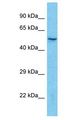 C14orf159 Antibody - C14orf159 antibody Western Blot of Jurkat. Antibody dilution: 1 ug/ml.  This image was taken for the unconjugated form of this product. Other forms have not been tested.