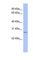 C14orf166 Antibody - C14orf166 antibody Western blot of Fetal Thymus lysate. This image was taken for the unconjugated form of this product. Other forms have not been tested.