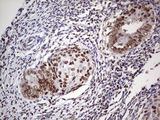 C14orf166 Antibody - IHC of paraffin-embedded Adenocarcinoma of Human endometrium tissue using anti-C14orf166 mouse monoclonal antibody. (Heat-induced epitope retrieval by 1 mM EDTA in 10mM Tris, pH8.5, 120°C for 3min).