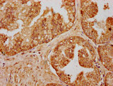 C14orf177 Antibody - Immunohistochemistry Dilution at 1:200 and staining in paraffin-embedded human prostate cancer performed on a Leica BondTM system. After dewaxing and hydration, antigen retrieval was mediated by high pressure in a citrate buffer (pH 6.0). Section was blocked with 10% normal Goat serum 30min at RT. Then primary antibody (1% BSA) was incubated at 4°C overnight. The primary is detected by a biotinylated Secondary antibody and visualized using an HRP conjugated SP system.