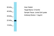 C15orf32 Antibody -  This image was taken for the unconjugated form of this product. Other forms have not been tested.