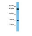C15orf33 Antibody - Western blot of Human Liver tumor. FAM227B antibody dilution 1.0 ug/ml.  This image was taken for the unconjugated form of this product. Other forms have not been tested.
