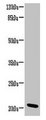 C15orf57 / CCDC32 Antibody - Western blot All lanes: CCDC32 antibody at 2µg/ml + HL60 whole cell lysate Secondary Goat polyclonal to rabbit IgG at 1/10000 dilution Predicted band size: 21, 22, 16 kDa Observed band size: 21 kDa