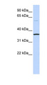 C16orf46 Antibody - C16orf46 antibody Western blot of Fetal Brain lysate. This image was taken for the unconjugated form of this product. Other forms have not been tested.