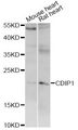 C16orf5 / I1 Antibody - Western blot analysis of extracts of various cell lines, using CDIP1 antibody at 1:1000 dilution. The secondary antibody used was an HRP Goat Anti-Rabbit IgG (H+L) at 1:10000 dilution. Lysates were loaded 25ug per lane and 3% nonfat dry milk in TBST was used for blocking. An ECL Kit was used for detection and the exposure time was 5s.