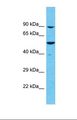 C16orf73 Antibody - Western blot of Human Uterus Tumor. MEIOB antibody dilution 1.0 ug/ml.  This image was taken for the unconjugated form of this product. Other forms have not been tested.