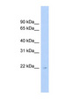 C16orf73 Antibody - C16orf73 antibody Western blot of Fetal liver lysate. This image was taken for the unconjugated form of this product. Other forms have not been tested.