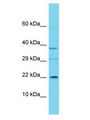 C16orf90 Antibody - C16orf90 antibody Western Blot of 721_B. Antibody dilution: 1 ug/ml.  This image was taken for the unconjugated form of this product. Other forms have not been tested.